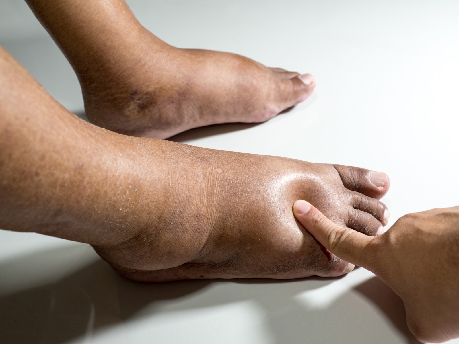 foot_1